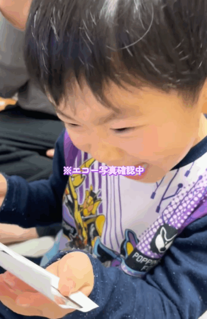 エコー写真を確認する息子さん（＠yuria_0000さんより提供）