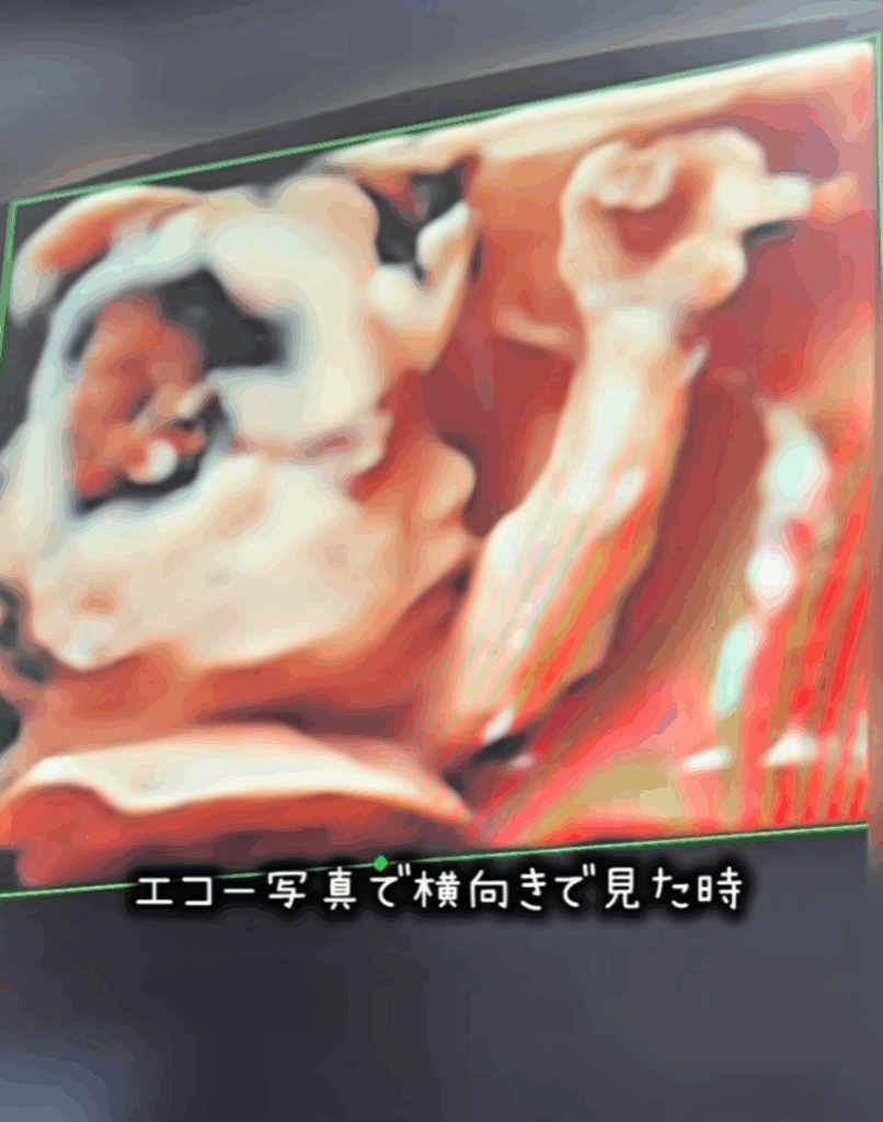 エコー写真では…（@okane_pinchiさんより提供）