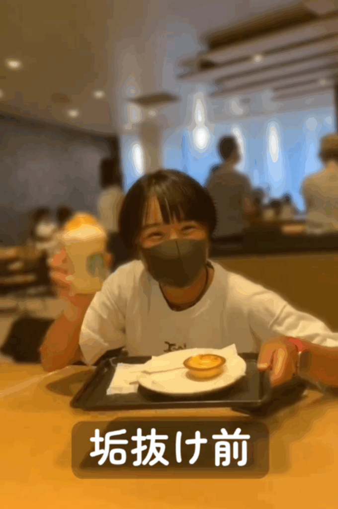 垢抜け前（@yuka_wanさんより提供）