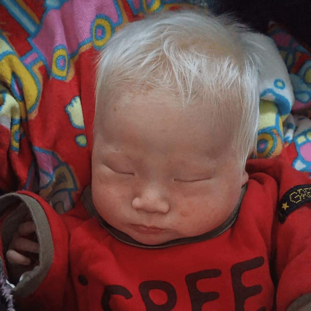 髪の毛が白くアルビノとして生まれた男の子。母の姿を見てみると…「素敵な愛情」「最強で最高な親子」　