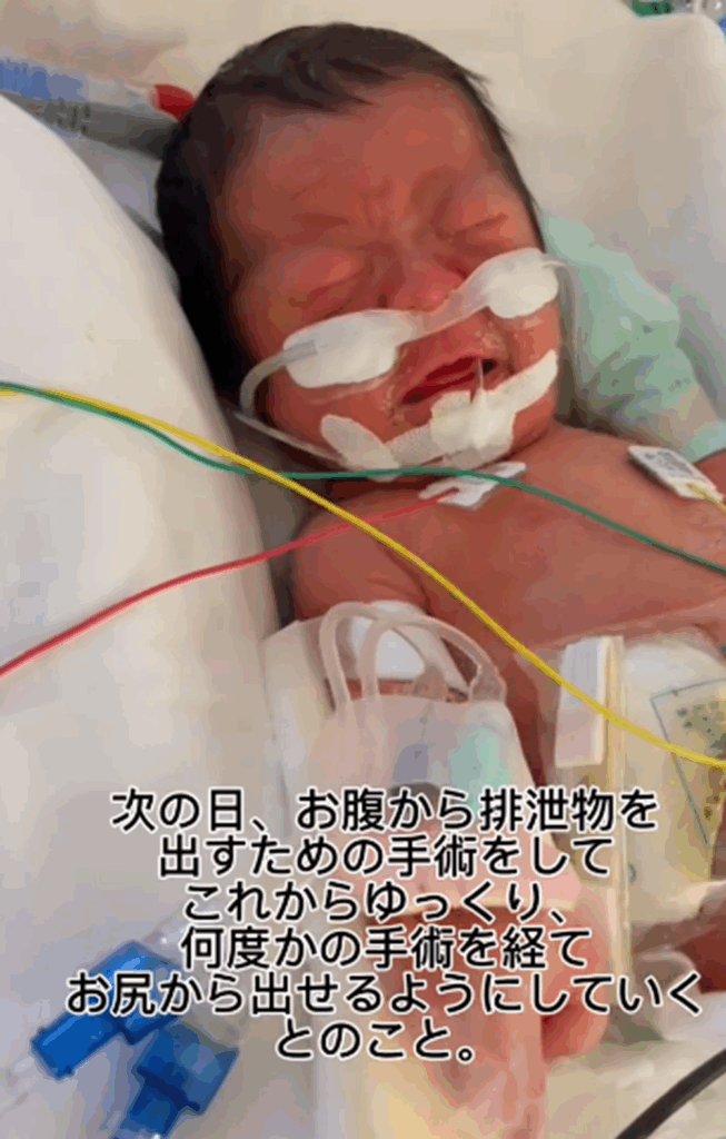次の日には手術を（@hutago_22さんより提供）