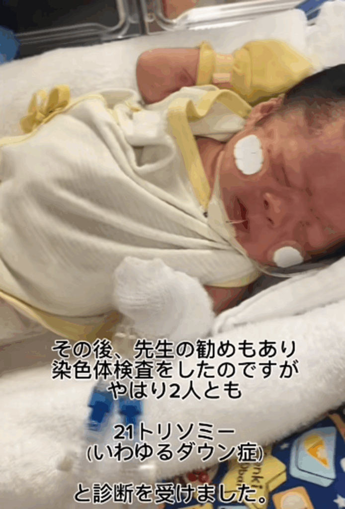 2人ともダウン症だと言われて（@hutago_22さんより提供）