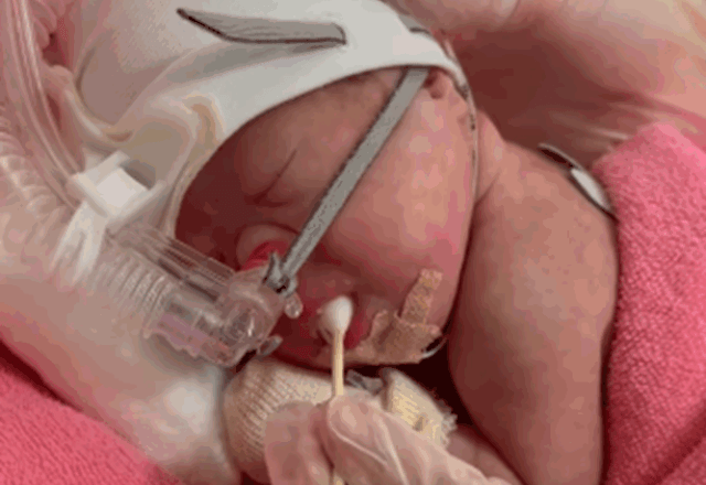 緊急帝王切開により661gで生まれた娘。その後ダウン症と診断されるも…生後1年たった現在の様子に迫る