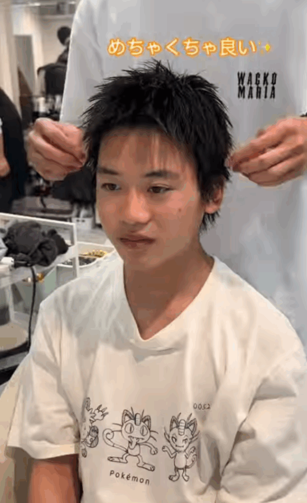 1回目の施術後（@kon.__meguroさんより提供）