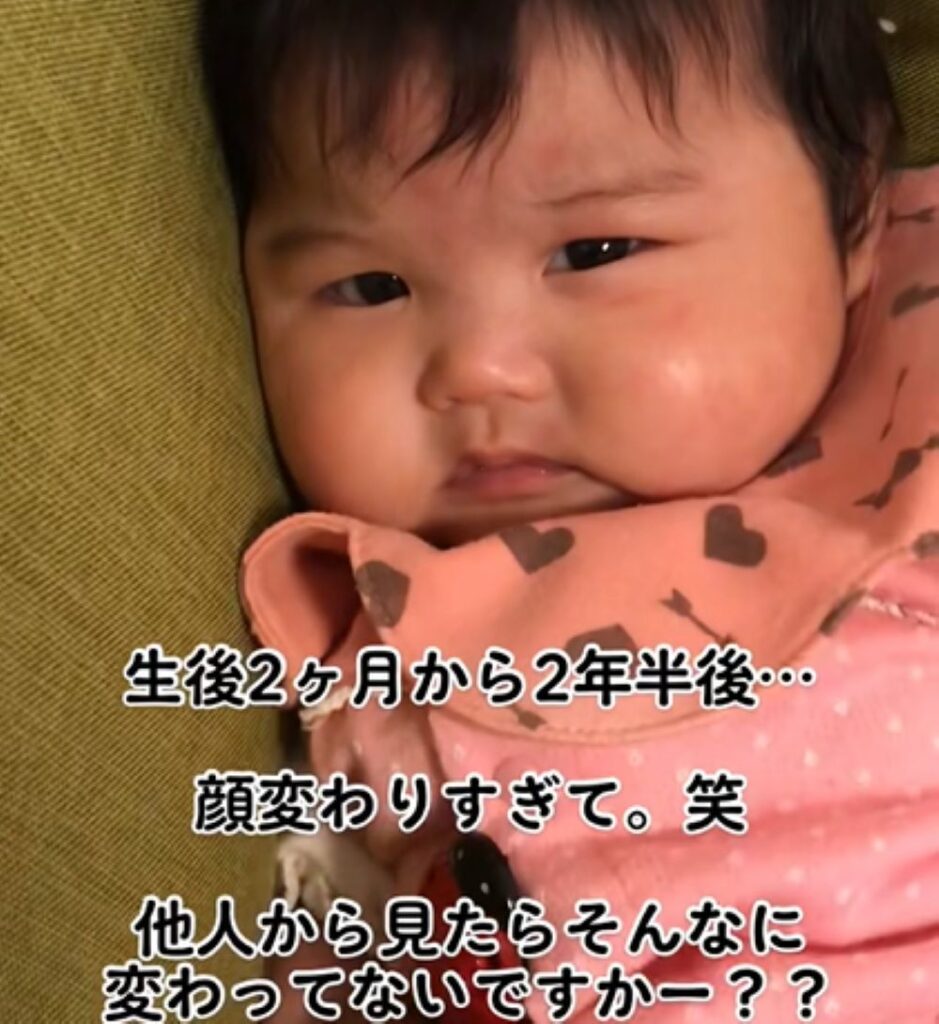 【実際の写真】「美人になる」と言われていた娘の2年後の衝撃の姿