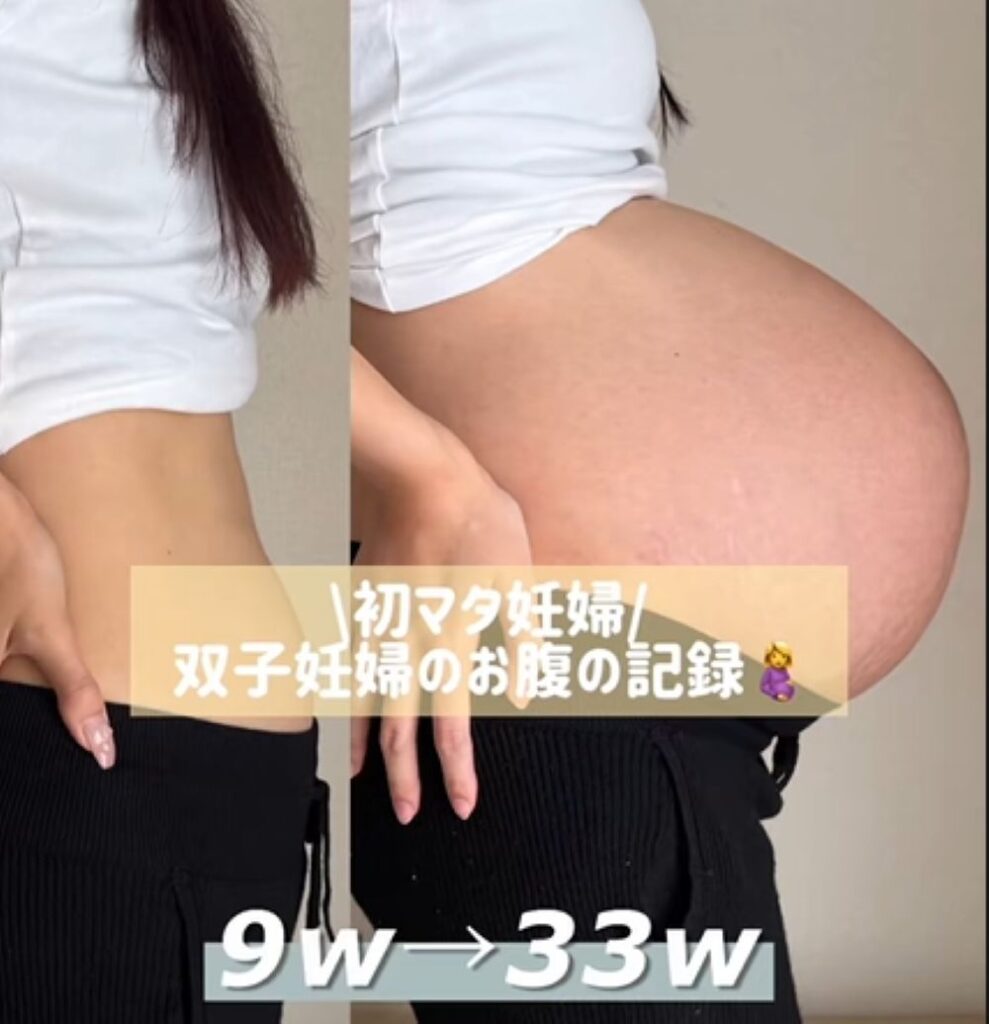 妊娠中のお腹の記録①（＠takarena_lifeさんより提供） – ほ・とせなNEWS, image size:989x1024