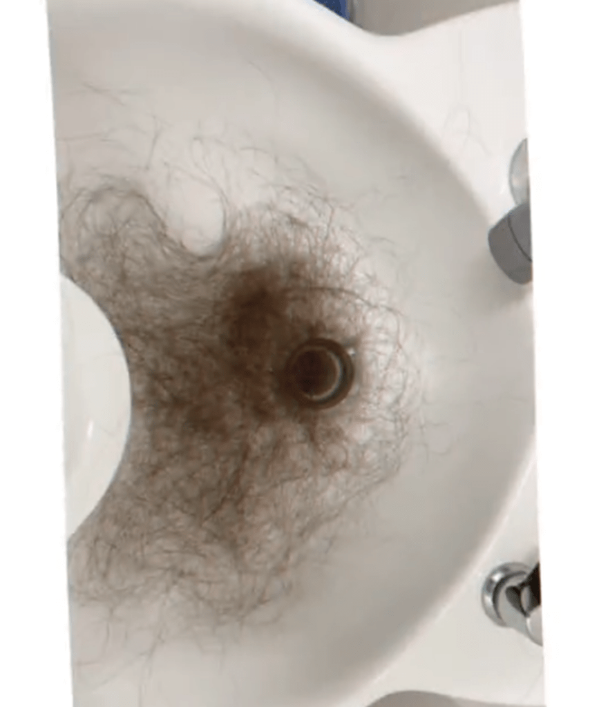 髪の毛が抜けて（@kananan_95さんから提供）