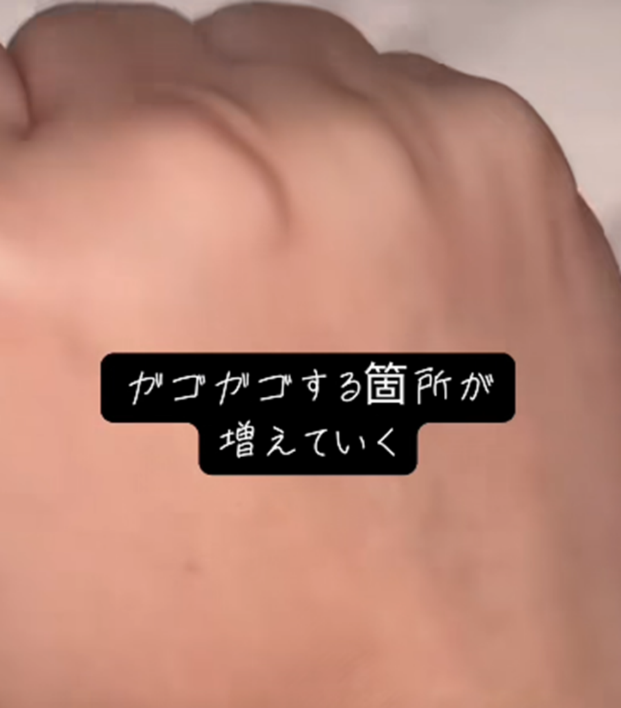 グラグラする箇所が増えていった（＠_m_o_m_o_m_o_さんより提供）