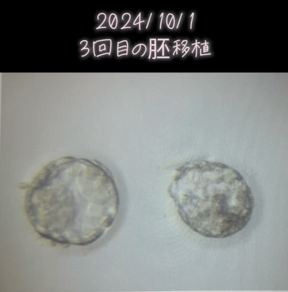 【実際の写真】現在の様子