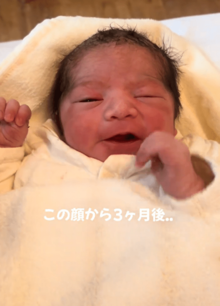 【実際の写真】3ヶ月後の姿