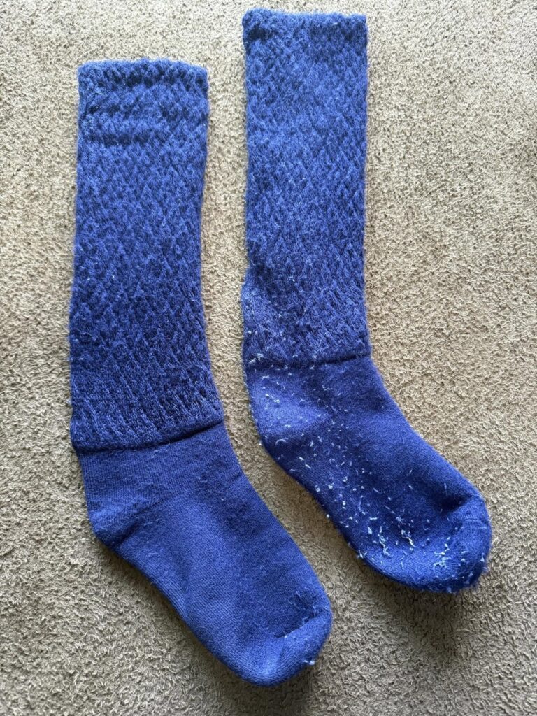 毛玉取りする前と後の靴下（＠tabemono_dokushoさんより提供）