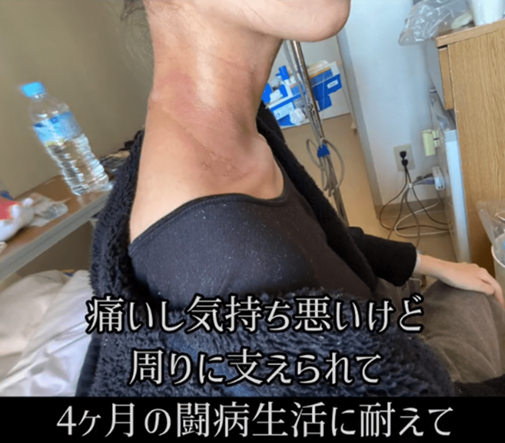 4ヶ月の闘病を乗り越えた（@onepunchman19961227さんより提供）