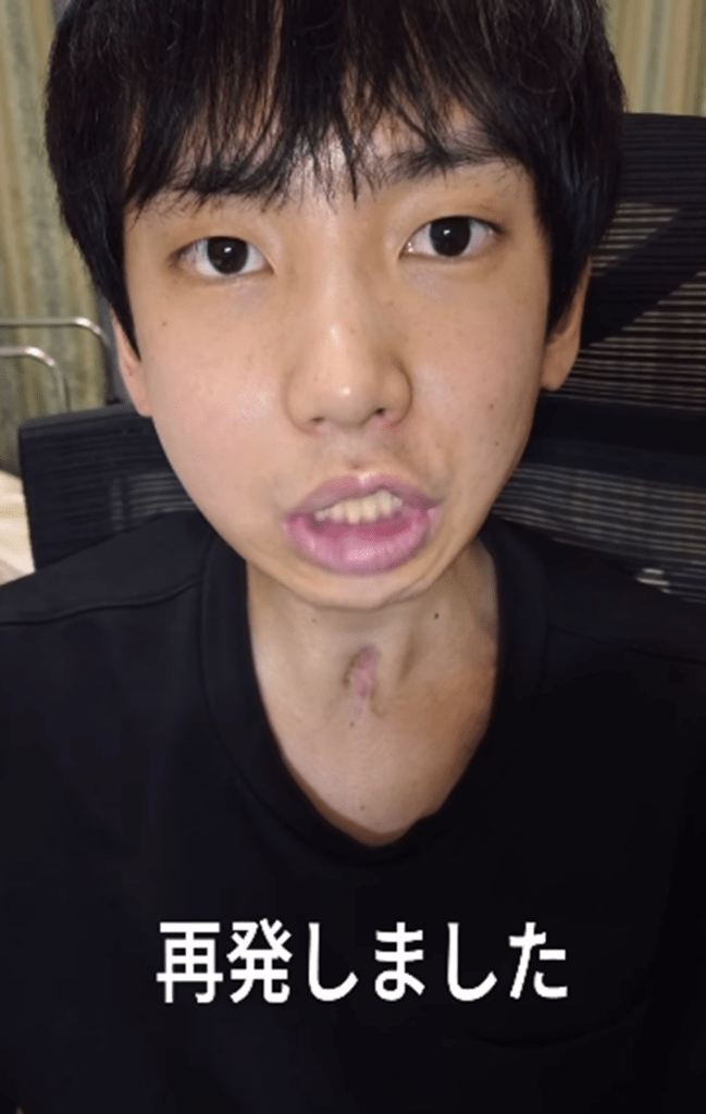 再発、転移も（＠nakano1224_2000さんより提供）