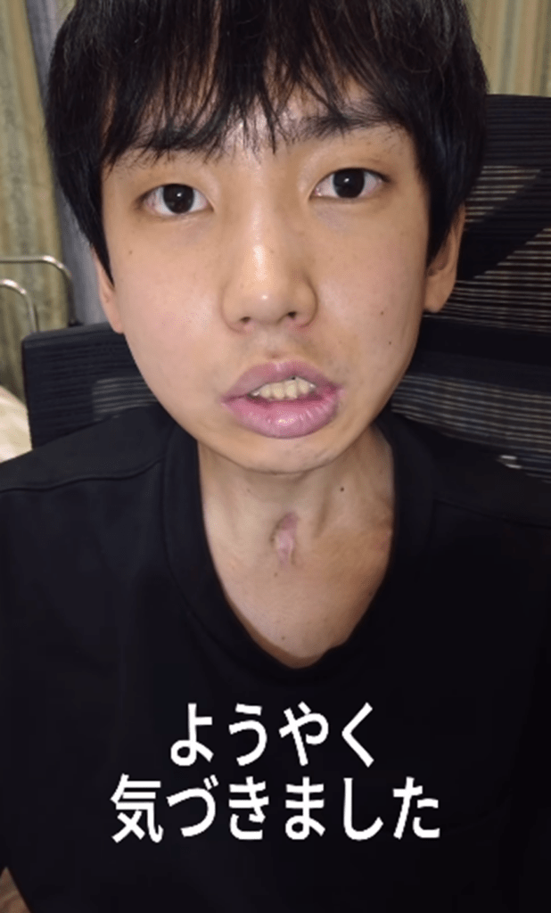 治療の過程で気づいたこと（＠nakano1224_2000さんより提供）