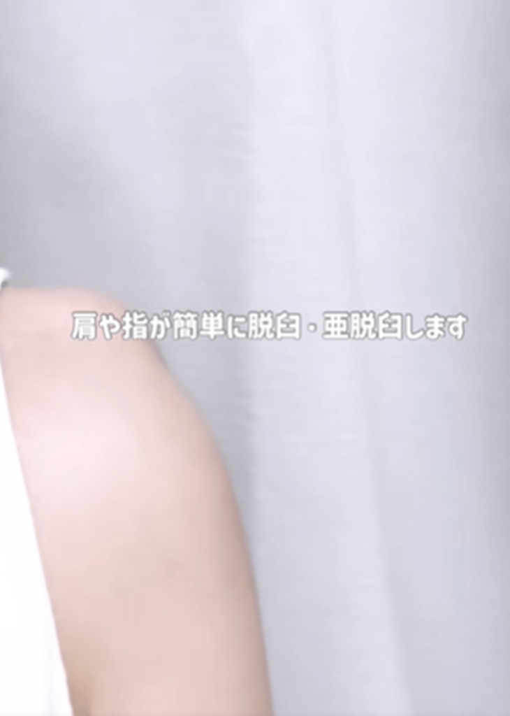 肩の脱臼（白妙ぬんさんより提供）