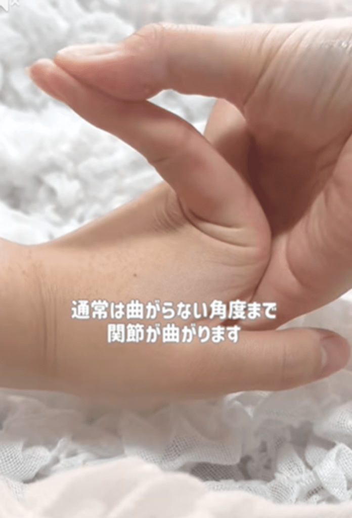 関節が曲がらないところまで曲がる（白妙ぬんさんより提供）