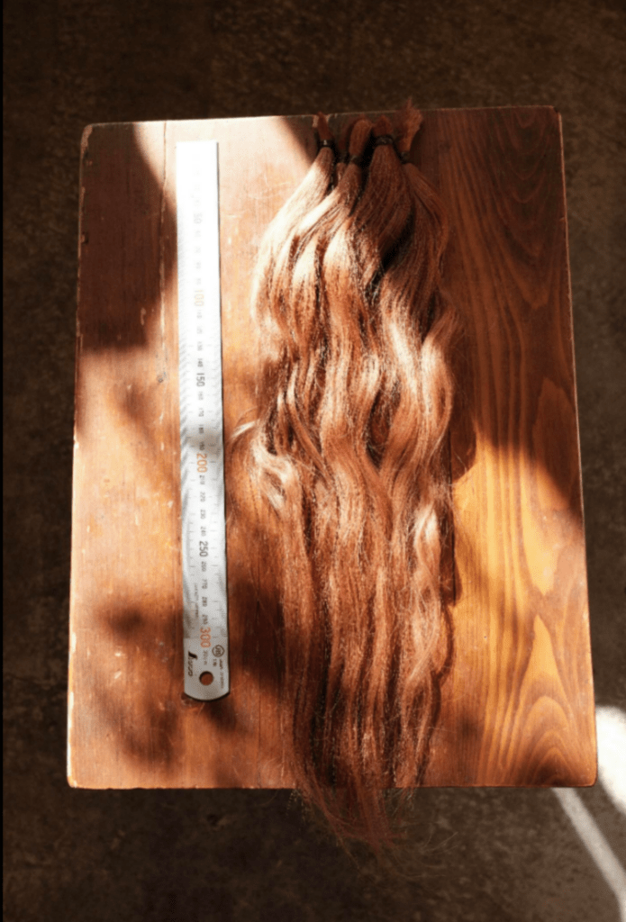 【実際の写真】がんになった好きな人の姿を見て衝撃を受けた7年後の姿