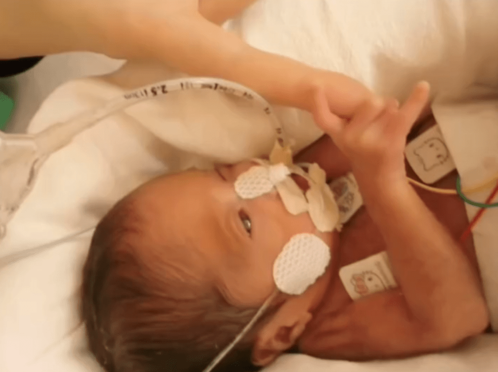 指を握り返す様子（＠yunon.yuanさんより提供）