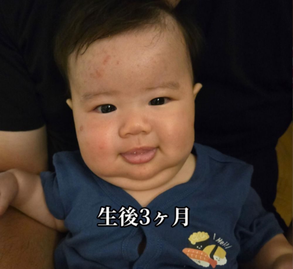 生後3ヶ月（＠mm172264さんより提供）