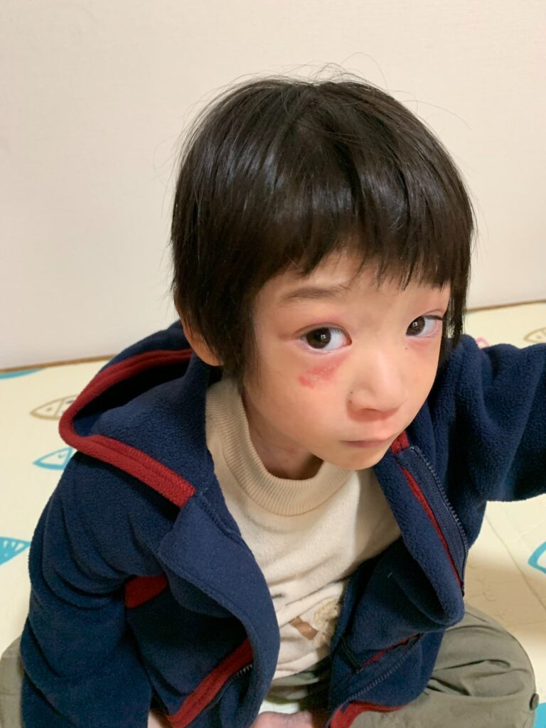 息子さん②（ママさんより提供）