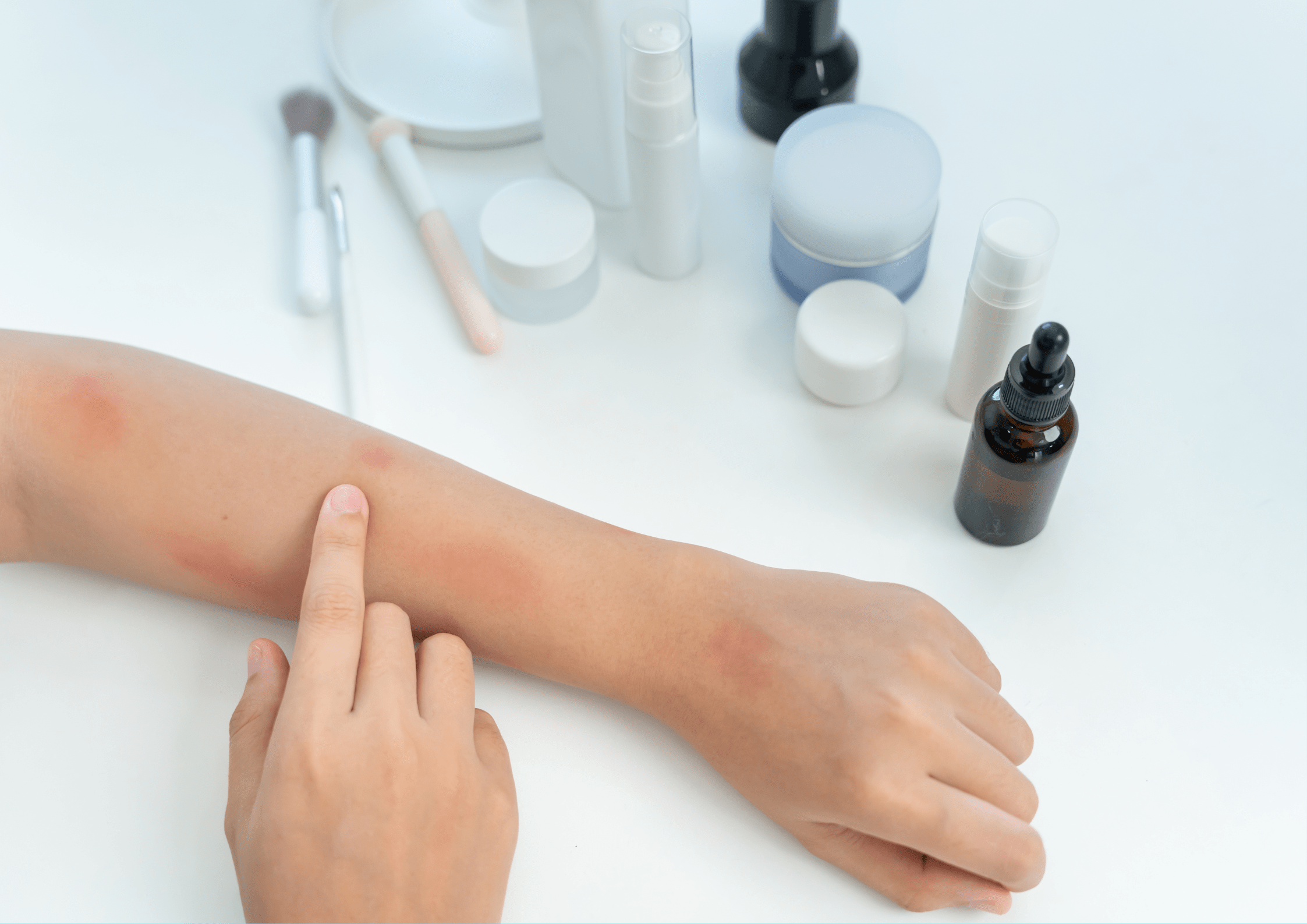 飲食店で…腕にかゆみを覚えた男性「あれ…」→しかしその後、判明した『衝撃の事実』に「これは…」「避けようがない」