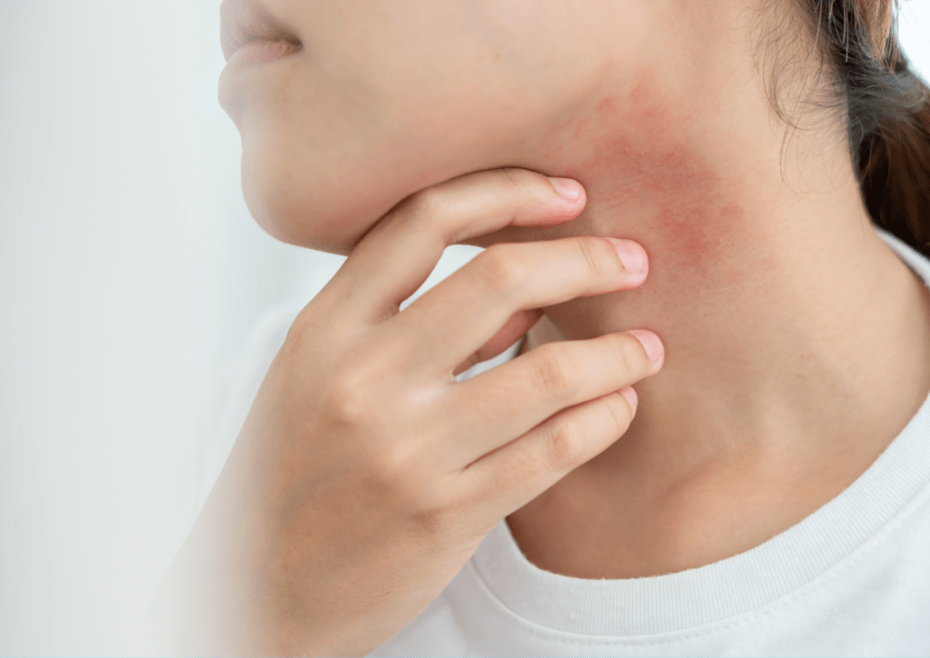 気温の変化で肌に違和感