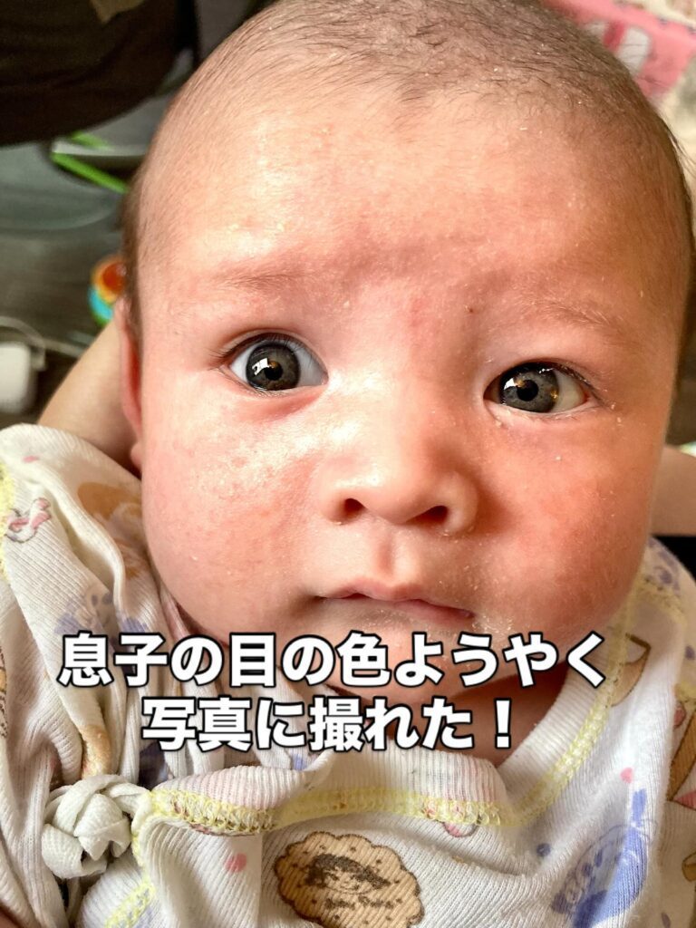 【実際の写真】瞳の色
