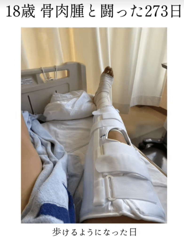歩けるようになった日（@mmn06.yさんより提供）