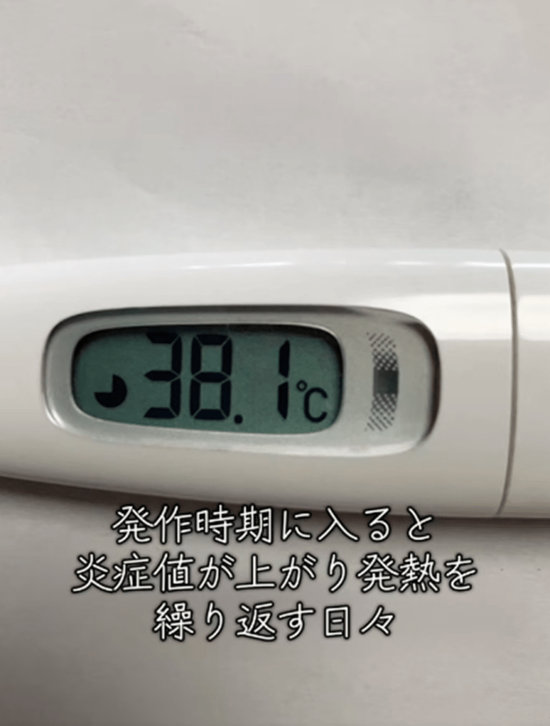 発熱を繰り返す発作時期（@nursestudent0918さんより提供）