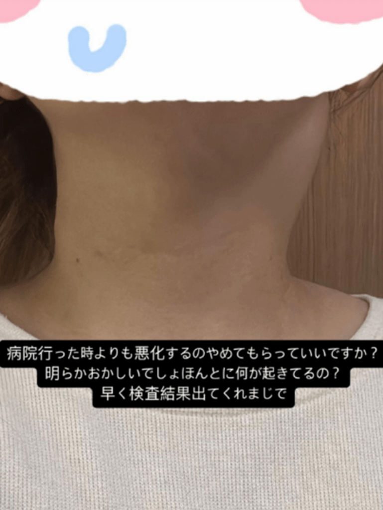リンパが腫れて（@darumacham_さんより提供）
