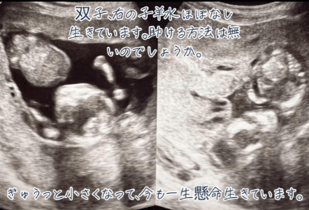 義妹さんが投稿してくれて（@keroppi__keroppiさんより提供）