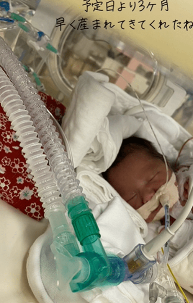 予定より3ヶ月早い誕生でした（@amizou105さんより提供）