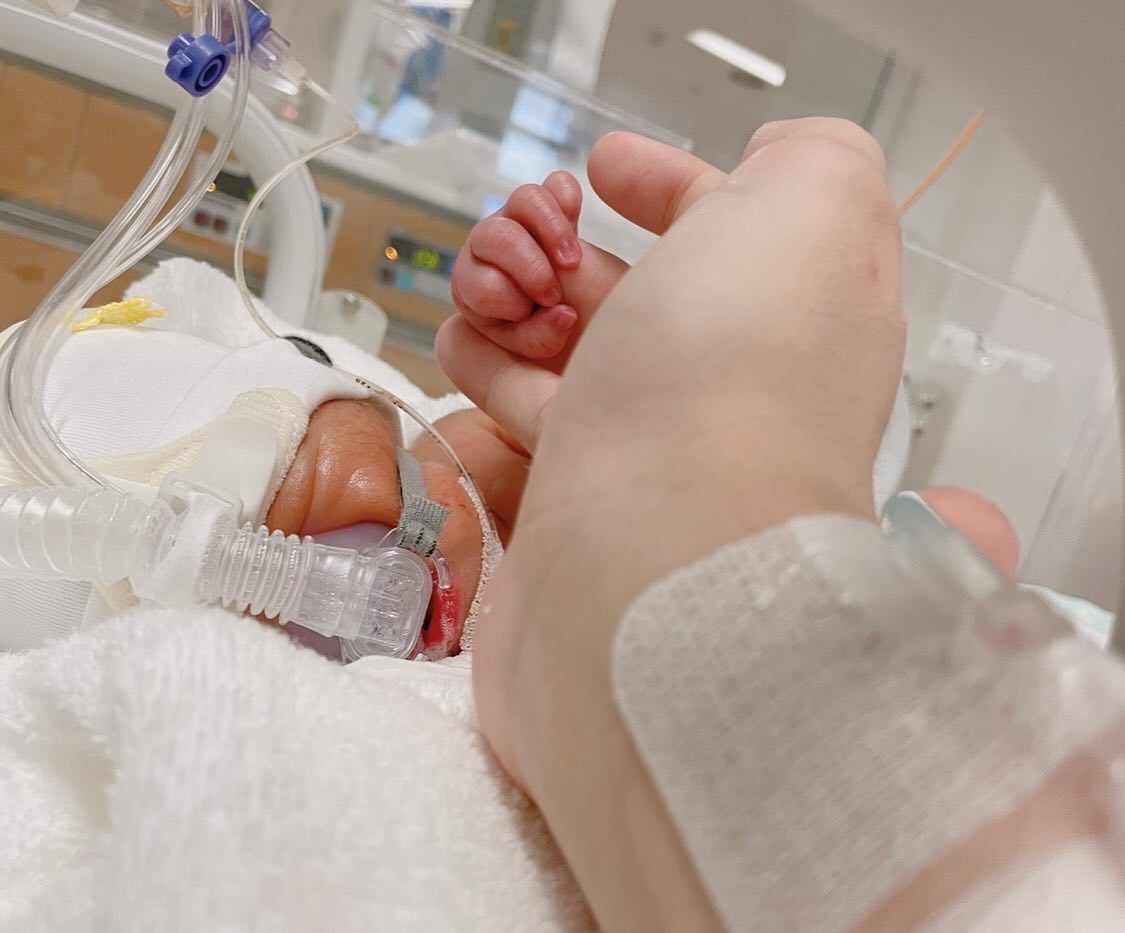 1700gで産まれ、すぐNICUに入った双子の赤ちゃん。しかし「今日ついに」待望の光景を迎え「お母さん、頑張りましたね」「愛おしい」