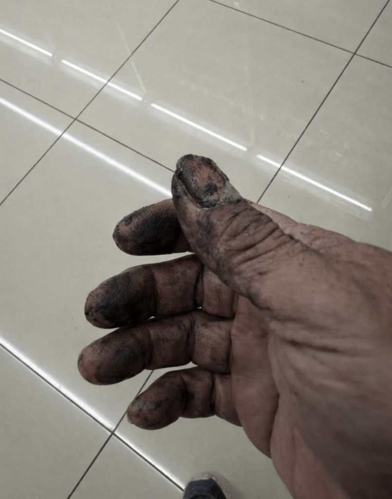 素手でチェーンを修理した結果（@to_ku_o_さんより提供）