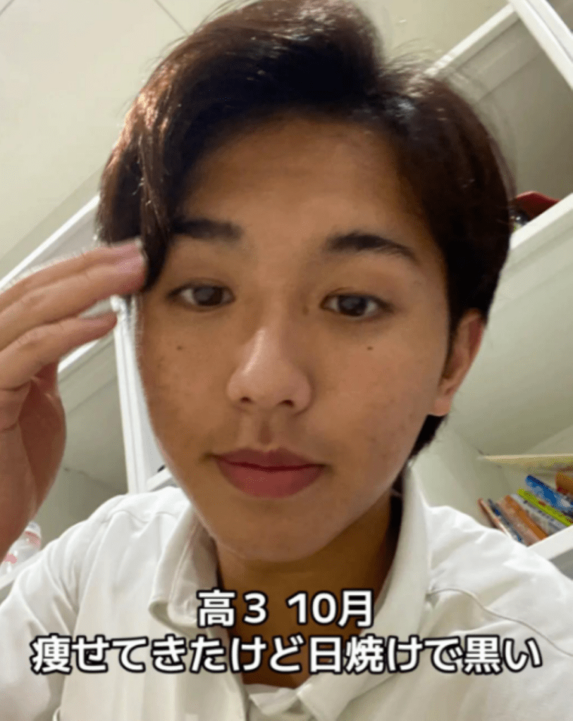 当時の悩み・日焼け（＠kumabe_takatomoさんより提供）