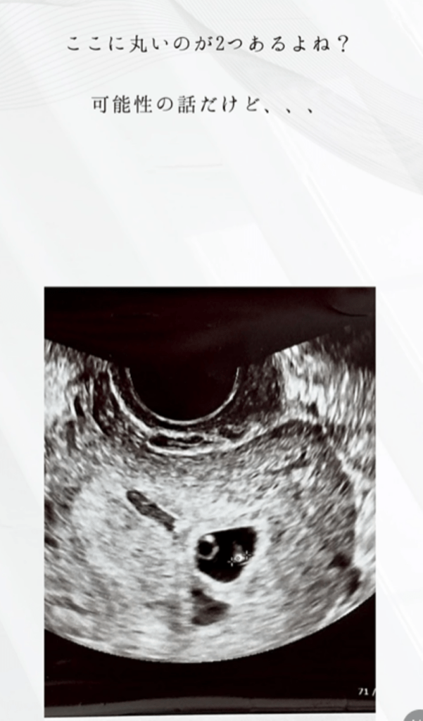 エコー写真と妊婦健診の様子③（＠moontwins.0810さんより提供）