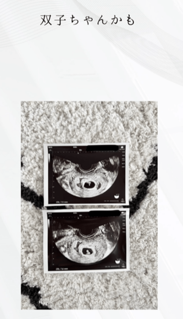 エコー写真と妊婦健診の様子④（＠moontwins.0810さんより提供）