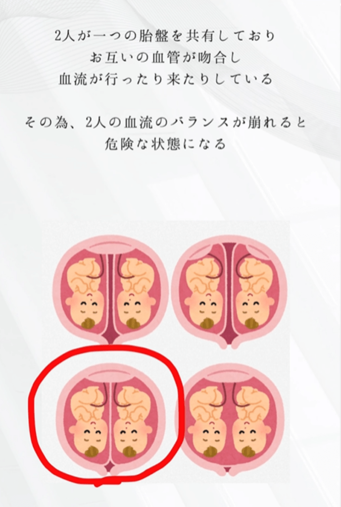 多胎妊娠について②（＠moontwins.0810さんより提供）