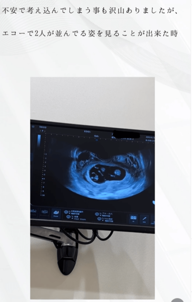 エコー画面①（＠moontwins.0810さんより提供）