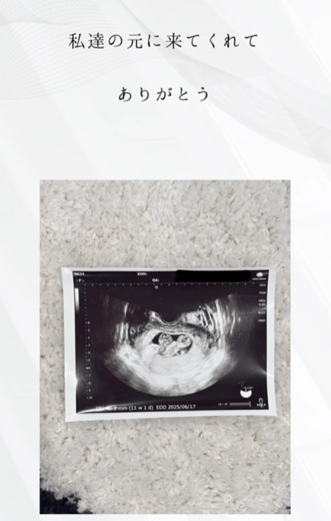 エコー写真（＠moontwins.0810さんより提供）