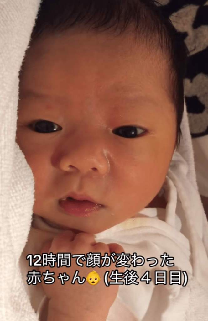 12時間で顔が変わった！？（@maruchanjp_tiktokさんより提供）