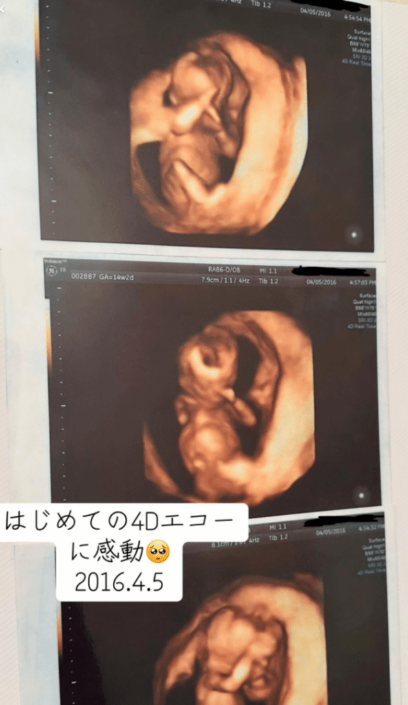 初めてのエコー（@maruchanjp_tiktokさんより提供）