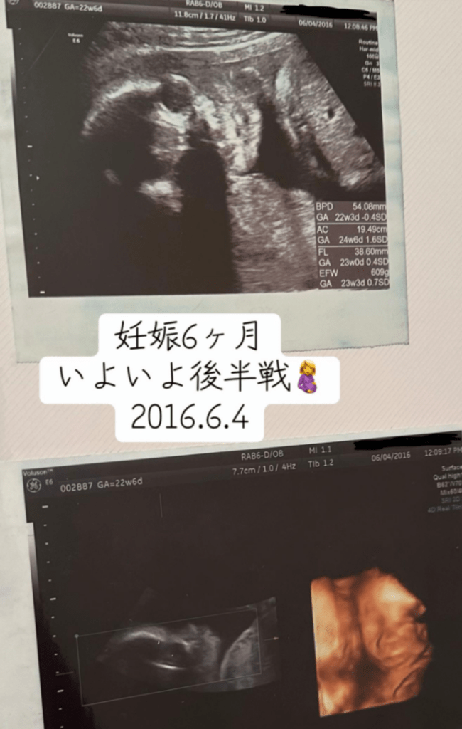 妊娠6ヶ月（@maruchanjp_tiktokさんより提供）
