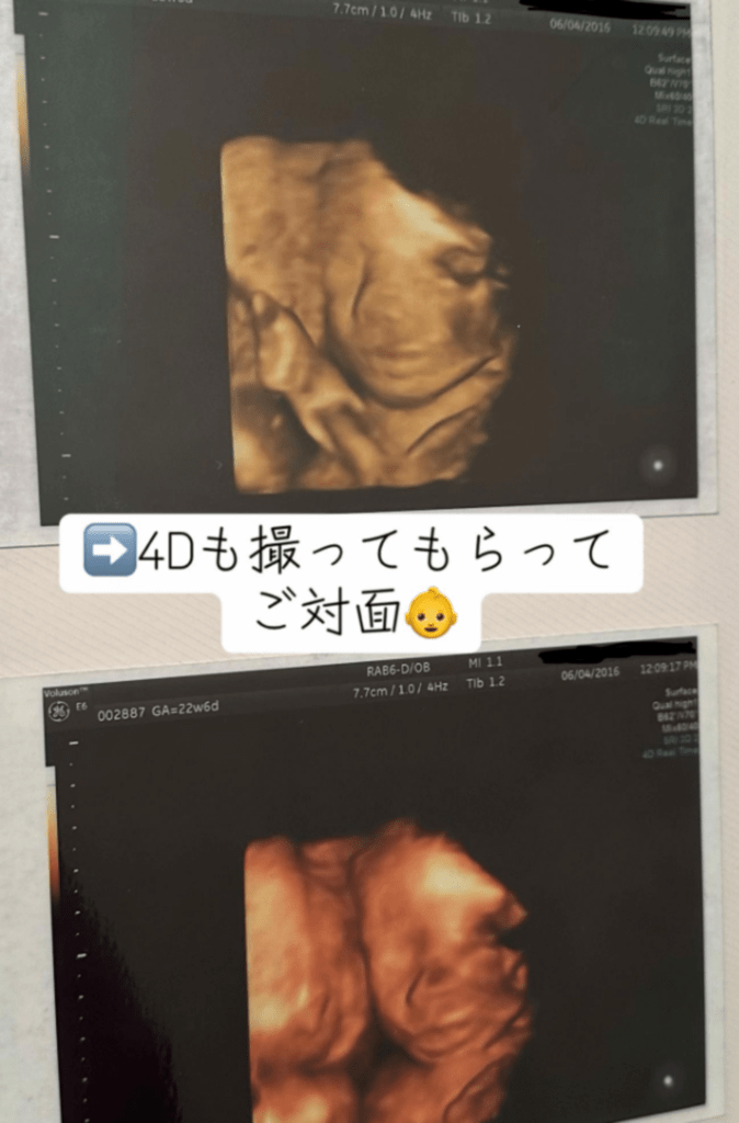 4Dで我が子との初対面（@maruchanjp_tiktokさんより提供）