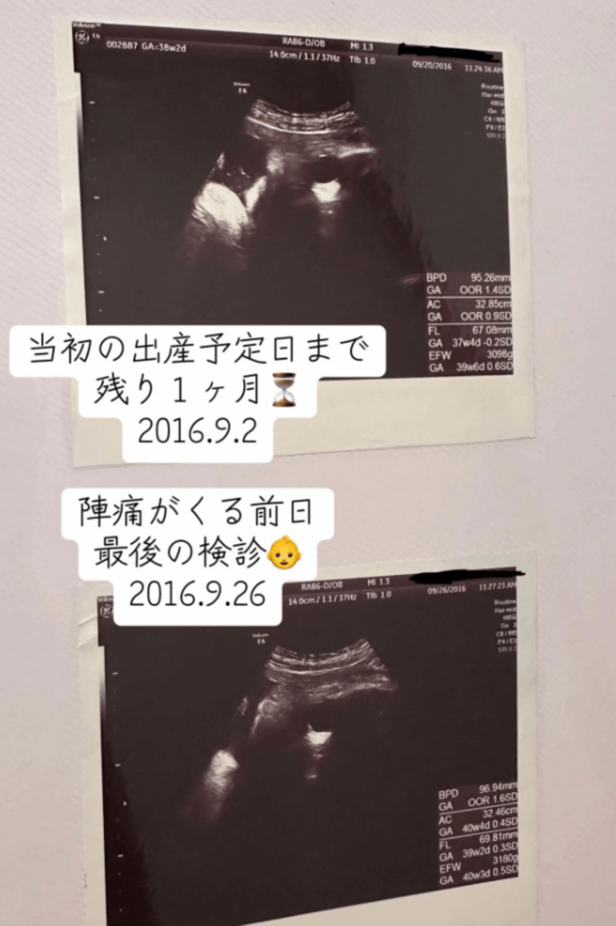出産間近（@maruchanjp_tiktokさんより提供）