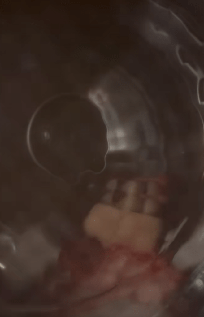 乾燥機にかける様子（＠sayu__mama_さんより提供）