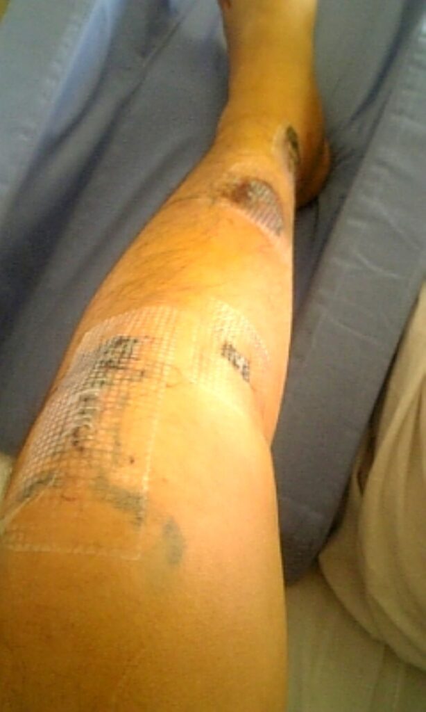 【実際の写真】　現在の様子