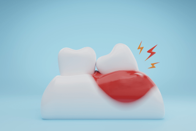 歯が割れている