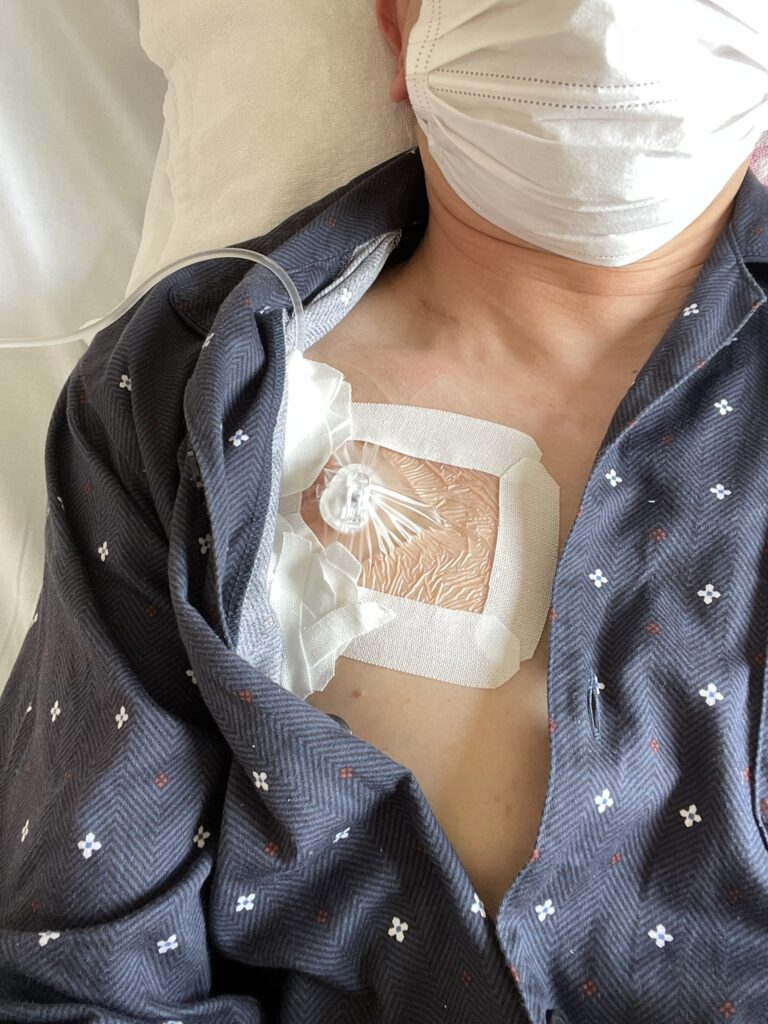 【実際の写真】入院中の様子