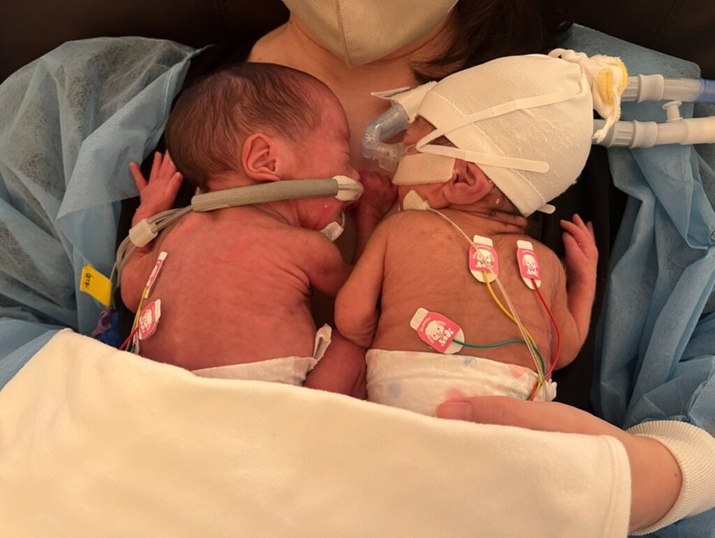 初めてのカンガルーケア（@keroppi__keroppiさんより提供）